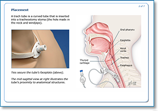 Illustrations and Diagrams